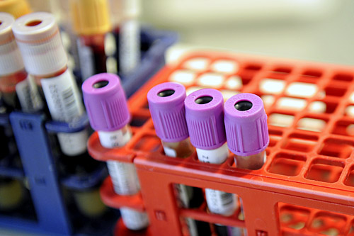 Nowa szczepionka może pomóc w walce z epidemią HIVAIDS. Testy wykazały, że szczepionka stworzona przez amerykańskich naukowców chroni przed chorobą niektóre małpy. Badacze testowali wirus SIV, atakujący na przykład rezusy.