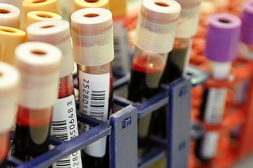 Drugi potwierdzony w Polsce przypadek zakażenia groźnym dla zdrowia typem bakterii E. coli. Chory to siedmiolatek z Giżycka, który od piątku leży w szpitalu w Warszawie.