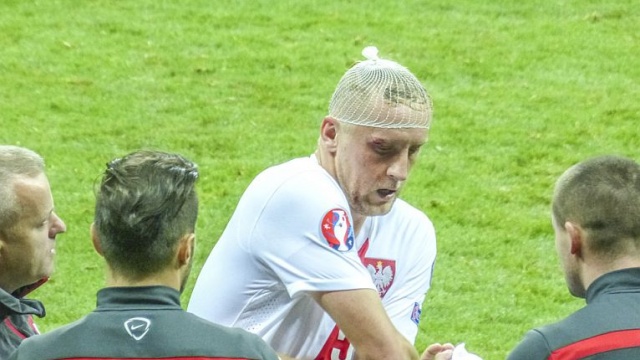 Kamil Glik w jednym ze starć doznał kontuzji łuku brwiowego. Fot. Tomasz Chaciński [Radio Szczecin] Nawałka: Eliminacje dopiero się rozpoczęły. W każdym meczu będzie wojna [WIDEO, ZDJĘCIA]