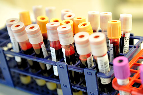 Test na HIV do użytku domowego wyprodukowała brytyjska firma Bio Sure UK - donosi portal rp.pl.