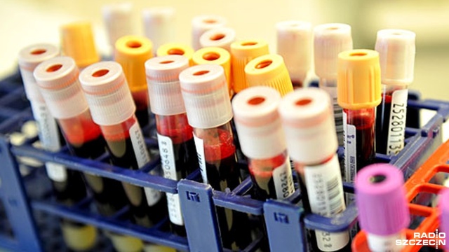 Lipidogram będą mogli bezpłatnie i bez kolejki wykonać w środę mieszkańcy Stargardu. To badanie, które określa poziom cholesterolu we krwi.