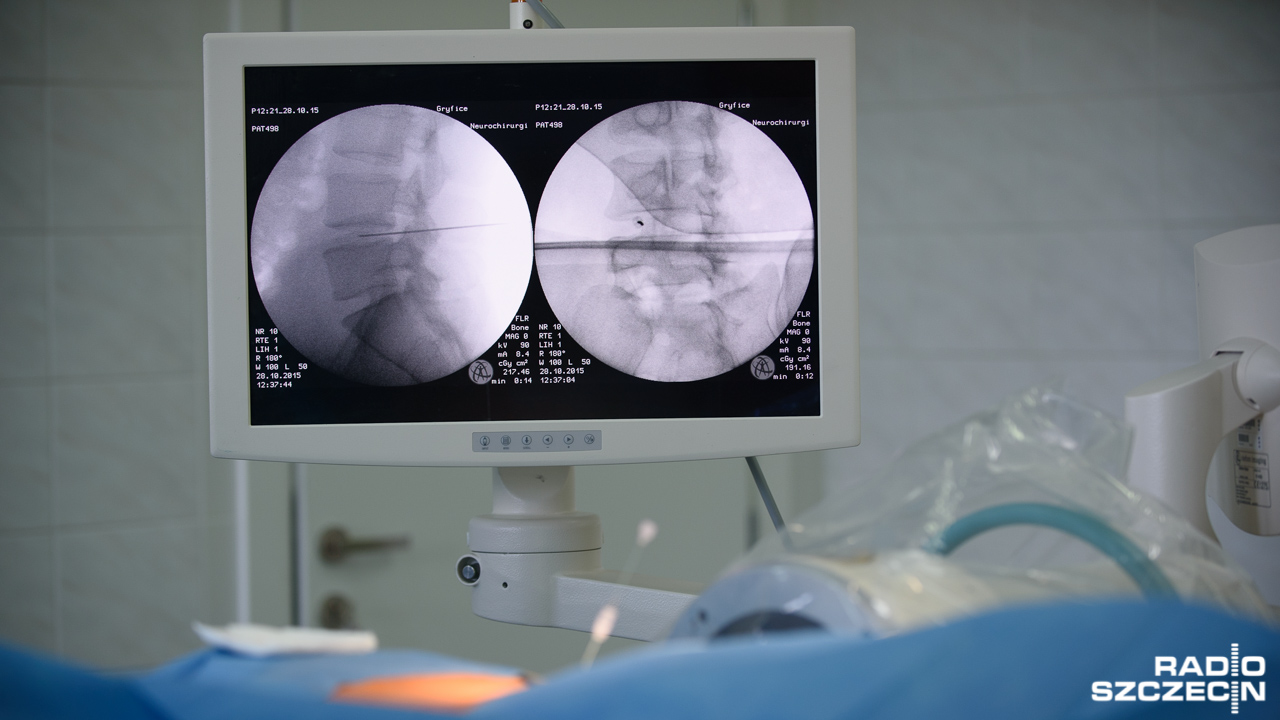 Praca przy komputerze, siedzący tryb życia, brak ruchu i przewlekły stres. To czynniki, które mogą wpływać na bóle kręgosłupa. Stają się one cichą epidemią i dotykają coraz młodszych.