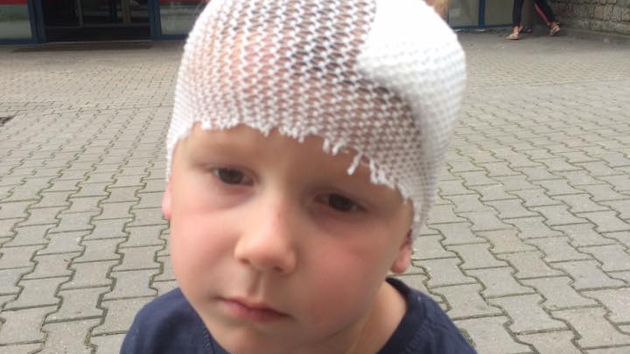 Rowerzysta, który w Szczecinie potrącił 5-latka, zgłosił się na policję. Z opinii świadków wynika, że nie uciekł. Chodzi o wypadek, do którego doszło w piątek, w okolicy ul. Zaleskiego. Chłopczyk doznał urazu głowy.