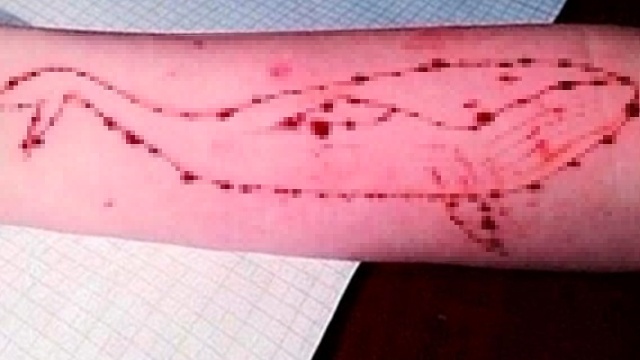 Prokuratura ostrzega przed grą niebezpieczną dla dzieci i potwierdza pierwsze przypadki samookaleczeń nastolatków w regionie. Chodzi o Niebieskiego Wieloryba czyli Blue Whale Challenge - grę, która stała się popularna m.in. w Rosji.