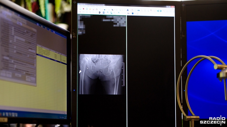 Operacje wszczepiania endoprotezy bez przetaczania krwi są wciąż rzadkością w Polsce. Mimo tego Szpital w Zdunowie podjął ryzyko przeprowadzenie „bezkrwawej operacji”. Fot. Olaf Nowicki [Radio Szczecin]