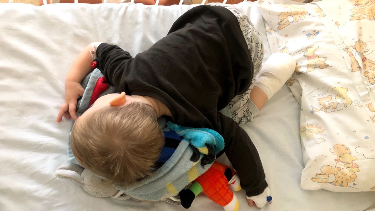 Rekordowa liczba przyjęć dzieci do Centrum Leczenia Oparzeń w szpitalu Zdroje w Szczecinie. Tylko we wrześniu trafiło tam 15 małych pacjentów w całym roku 70.