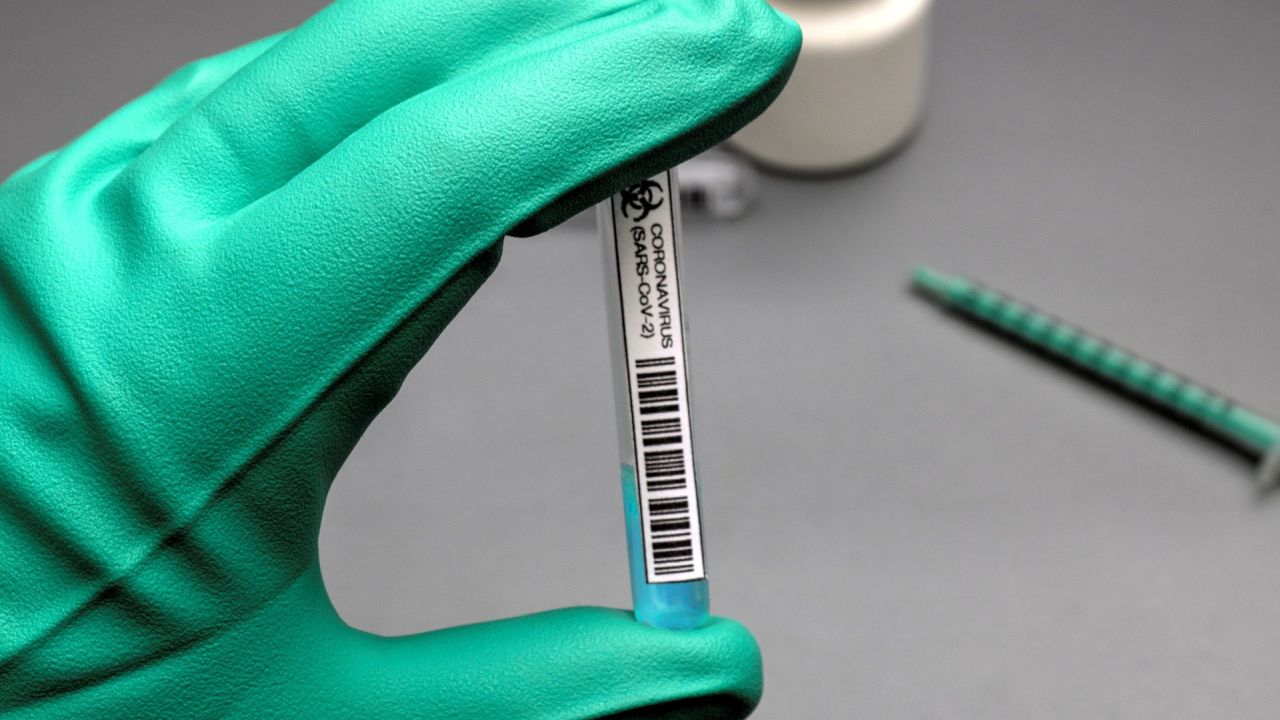 Kolejne miejsce, gdzie można zrobić test na obecność koronawirusa powstało w Kołobrzegu. Punkt wymazowy od środy działa w Pomorskim Centrum Medycznym przy Alei Kolejowej.