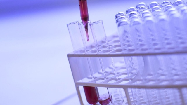 Potwierdzono obecność wirusa grypy H5N8 na fermie indyków w Rościnie w powiecie myśliborskim.