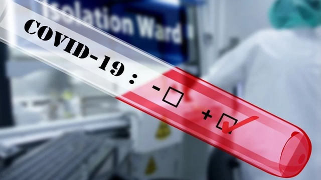 W szpitalu przy ul. Arkońskiej zmarła 69-letnia pacjentka ze Szczecina. To już 20 ofiara epidemii w regionie.