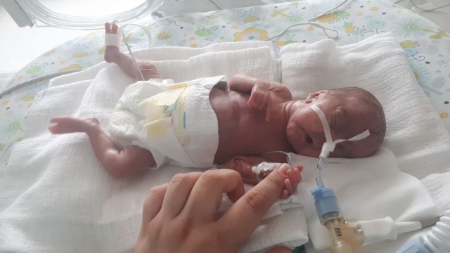 Co dziesiąte dziecko, które od początku tego roku urodziło się w szpitalu Zdroje w Szczecinie to wcześniak. Najmniejszy ważył niewiele ponad pół kilograma.