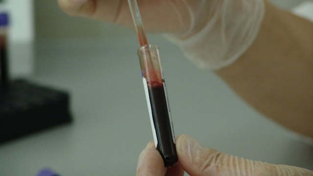 W przypadku zakażenia wirusem HIV najważniejsza jest szybka diagnoza - mówi prof. Miłosz Parczewski, lekarz kierujący oddziałem obserwacyjno-zakaźnym w Szpitalu Wojewódzkim w Szczecinie i prezes Polskiego Towarzystwa Naukowego AIDS.