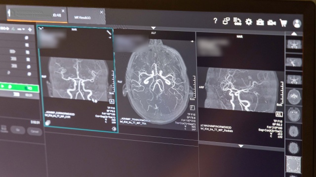 Fot. Robert Stachnik [Radio Szczecin] Rezonans w szpitalu MSWiA dostępny dla pacjentów z klaustrofobią [WIDEO, ZDJĘCIA]