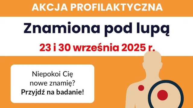 Szpital Miejski w Świnoujściu apeluje do mieszkańców: nie ignorujcie zmian skórnych. Już w najbliższą sobotę, 19 września, placówka organizuje kolejną odsłonę bezpłatnej akcji profilaktycznej pod hasłem Znamiona pod lupą.