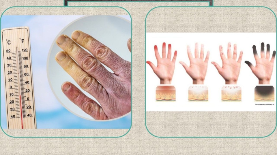 Pomoc medyczna dla osób w kryzysie bezdomności