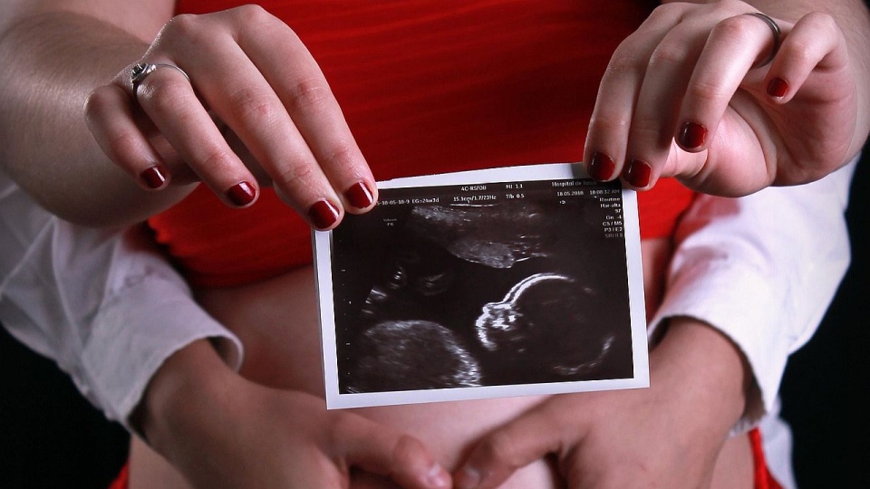 "Ideą jest holistyczne podejście do pacjentek z endometriozą"