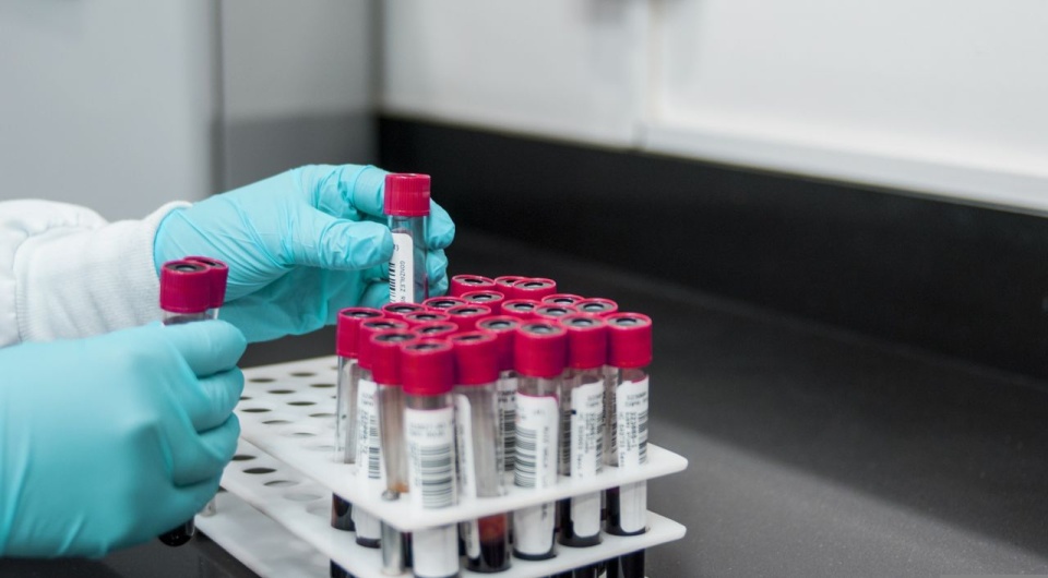 Test w kierunku HIV, HCV i kiły można wykonać bez skierowania, za darmo i anonimowo